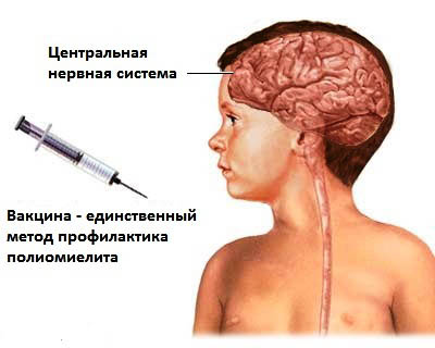 иммунизация полиомиелитной вакциной в Украине